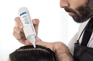 scalpservice 1024x666