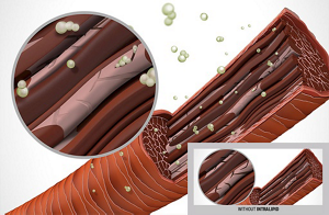ds rich repair technology intralipid