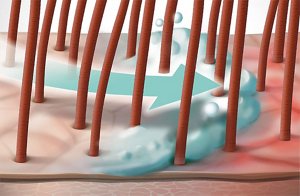 ds scalp specialist technology lime tree