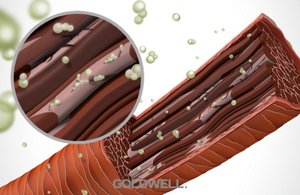 intralipid technology