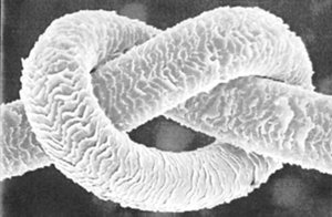 elumen benefits knot conventional