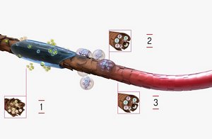 innereffect technology