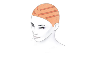 colorance educationdetail teaser vintage peach head 2017