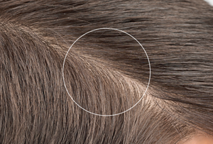 Microscopische vergelijking van haar in close-up met de Dualsenses Guarana- en Cafeïne-technologie van Goldwell; close-up van bruin haar met cirkelvormige overlays, waarbij het haar wordt vergeleken met een zichtbaar verkwikte en verfriste hoofdhuid