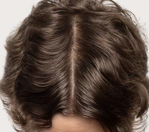 Goldwell Dualsenses Scalp Specialist after image showing the top of a person’s brown hair with a cleaner-looking scalp part.