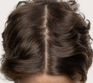 Goldwell Dualsenses Scalp Specialist before image showing the top of a person’s brown hair with a visible scalp part.