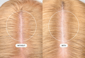Bild zur Goldwell Dualsenses Scalp Specialist-Technologie mit Weißtee-Extrakt, das blondes Haar und die Kopfhaut zeigt, wobei nebeneinander angeordnete kreisförmige Überlagerungen den Unterschied zwischen der Anwendung ohne und mit Kopfhautpflege verdeutlichen.