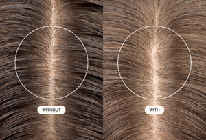 Bild zur „Goldwell Dualsenses Scalp Specialist“-Technologie mit Himbeersamenöl, das blondes Haar und die Kopfhaut zeigt, mit nebeneinander angeordneten kreisförmigen Überlagerungen, die den Unterschied zwischen der Anwendung ohne und mit Kopfhautpflege verdeutlichen.