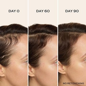 117486_717226295737_JF_UF_Scalp_Serum_BeforeAfter-02