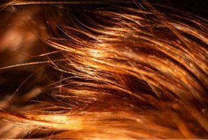 Blog Landscape 616 x 413 - Greasy_Hair_3