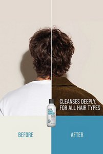 kmshair_PP_PDP_desktop_HR-DeepCleanse-BeforeAfter